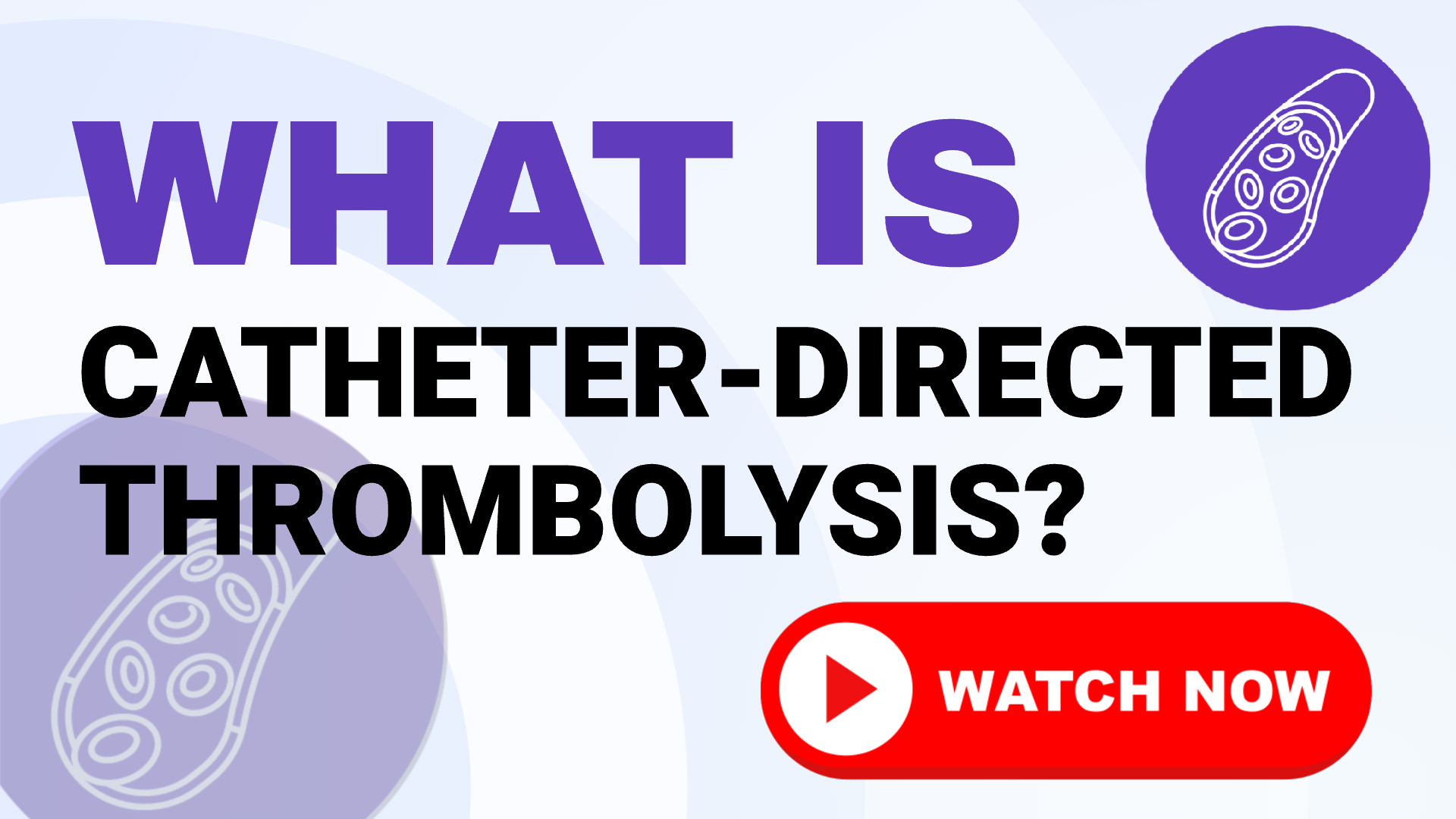 Catheter Directed Thrombolysis